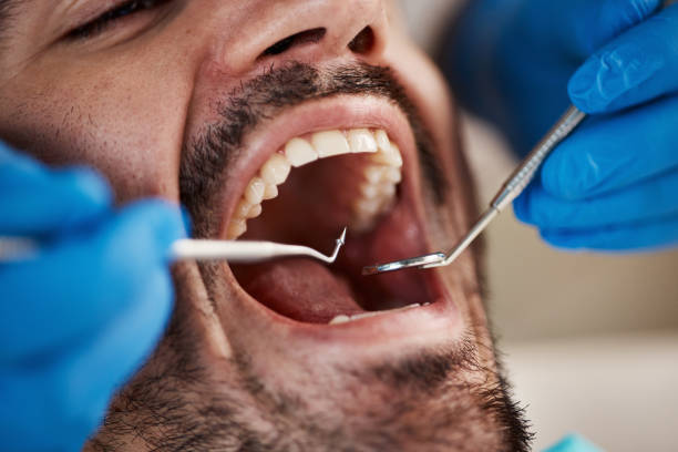 Best Pediatric Emergency Dentist in Coarsegold, CA