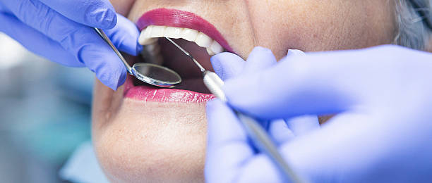 Best Emergency Dental Care for Broken or Chipped Teeth in Coarsegold, CA